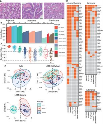 The Comparable Microenvironment Shared by Colorectal Adenoma and Carcinoma: An Evidence of Stromal Proteomics